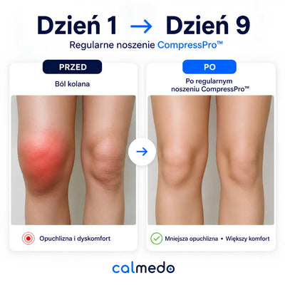 Calmedo CompressPro™ - Bambusowa orteza stabilizująca na kolano